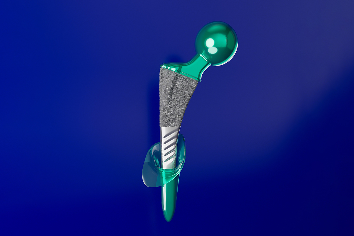 Hip prosthesis with Masking 1200 Peeling Green UV Masking