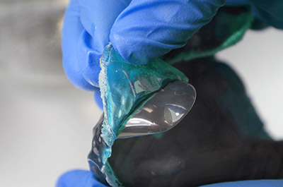 Peeling off a uv maskant from an artificial joint